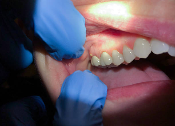 Best 24-Hour Emergency Dental Care in Oakley, KS